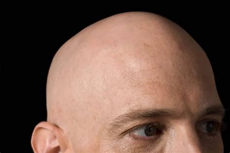 11 Fantastic Benefits Of Being Bald For Men That Will Blow Your Mind