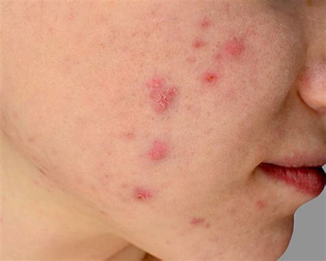 Top 10 Skin Disorders a Dermatologist Encounters