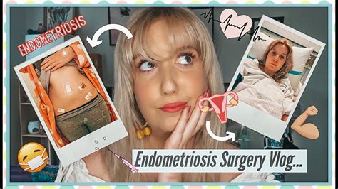 ENDOMETRIOSIS SURGERY VLOG | REAL AND HONEST RECOVERY. 🤕😷 - YouTube