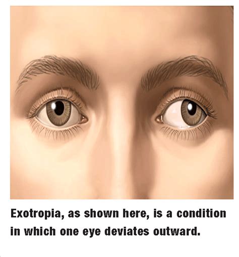 Review of Optometry® > Do You See a Pattern? | Optometry, Pattern