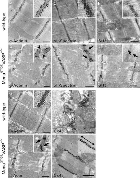 Mena/VASP double deficiency impairs Z- and intercalated disc integrity.... | Download Scientific ...