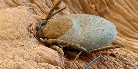 Как да се справим с кърлежите през лятото | Microscopic photography, Ticks, Electron microscope