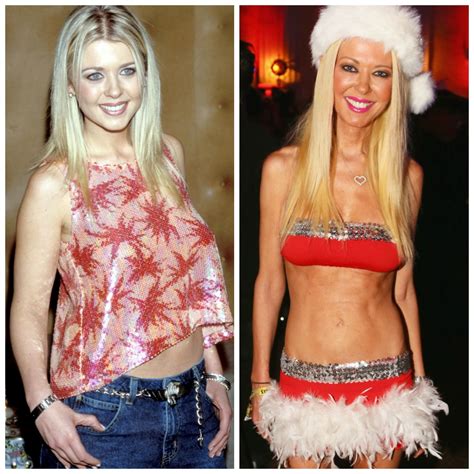 Plastic Surgery Gone Wrong — Celebs Who Regret Going Under the Knife!