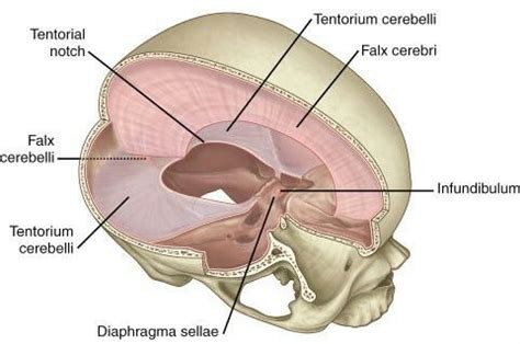 1.Falx cerebri 2.Tentorium cerebelli - incisura of the tentorium/tentorial notch 3. Falx ...