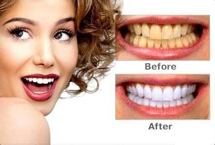 Tips for brighter smile! | Стоматологический юмор, Здоровье, Предложения