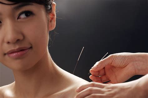 Dry Needling Benefits - Balanced Body Acupuncture & Chiropractic