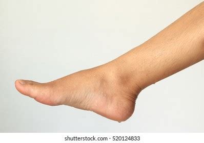 7,769 Sweating feet Images, Stock Photos & Vectors | Shutterstock