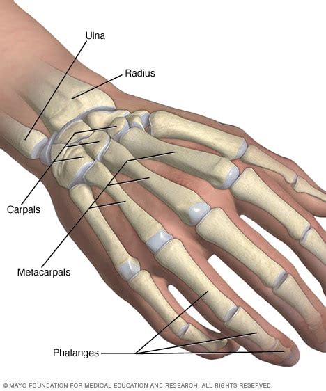 Broken hand - Symptoms & causes - Mayo Clinic