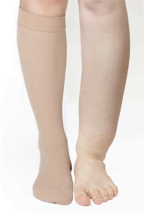 How do Compression Stockings Work on Fluid Edema?-Compports