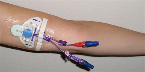 PICC Line Blood Draw Explained - E Phlebotomy Training