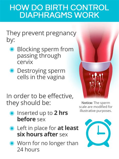 Birth Control Diaphragm | SheCares