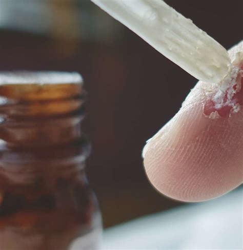 Salicylic acid wart removal: Effectiveness and how to use