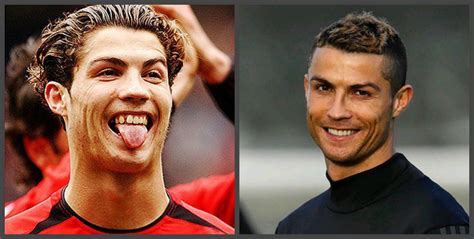 Cristiano Ronaldo - dentes antes e depois, uma seleção de fotos