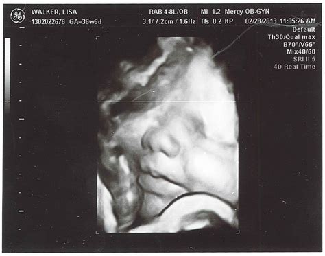 Pages From the Pursuit: Photos: Baby Boy Ultrasound at 37 weeks