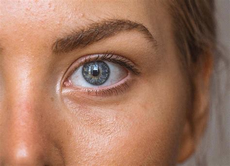 The 3 Best Under-Eye Filler Alternatives | RealSelf News