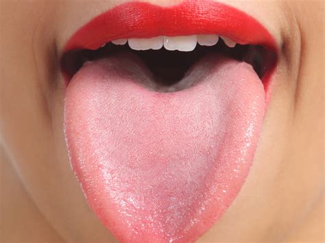 What is the colour of a healthy/normal tongue?