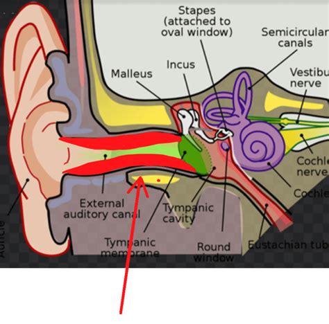 Ear Infections - Medical Care One