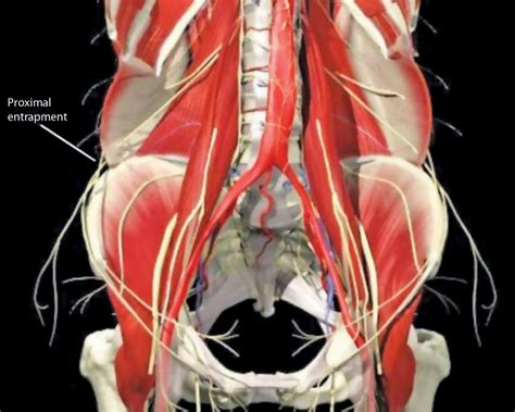 Ilioinguinal and Iliohypogastric Nerve Blocks | Anesthesia Key