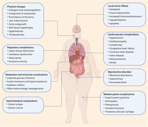 Classic clinical signs and symptoms of acromegaly | Download Scientific Diagram