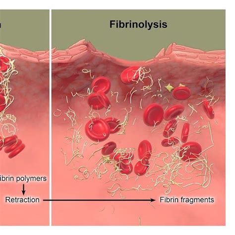 Core BioVisuals on Twitter: "Part 1/3 Blood Coagulation illustration. Fibrinolysis. ... Visit ...