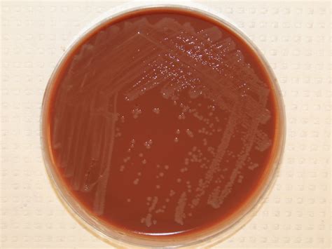 Neisseria meningitidis Virtual Lab Microbiology