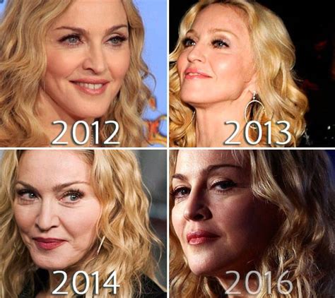 Madonna Face Lift