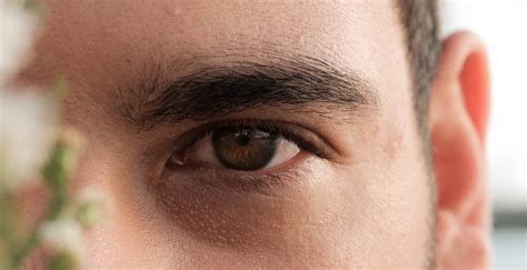 Discover 81+ wrinkles bags under eyes best - in.cdgdbentre