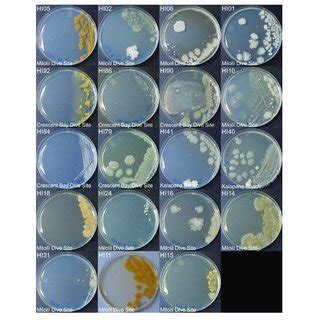 | Representative bacterial colonies with different morphologies growing... | Download Scientific ...