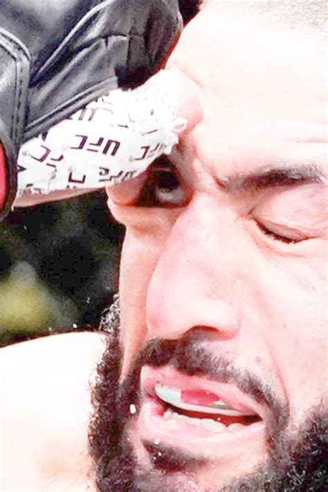 Belal Muhammad was unable to continue after a sickening eye poke
