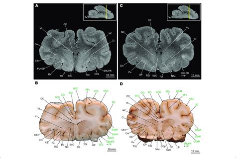 | MRI imaging and cross sections through the middle part of... | Download Scientific Diagram