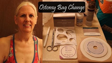 Ostomy Bag Change / How to Change an Ileostomy Bag - YouTube