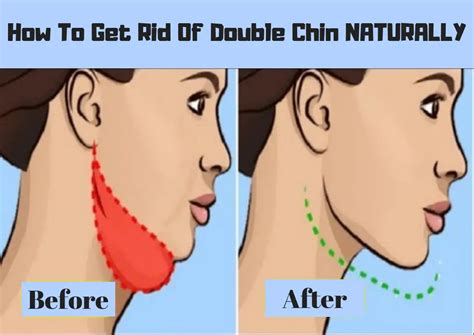 How To Get Rid Of Double Chin FAST! (BEST Double Chin Exercises)