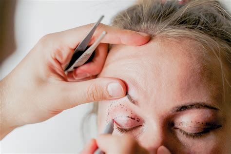 Eyelid Surgery - Blepharoplasty - Santa Rosa