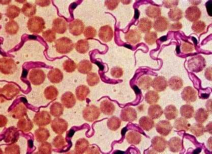 Trypanosoma cruzi found in blood. | FISIOPATOLOGIA | Parasitologia, Biologia geral e Medicina