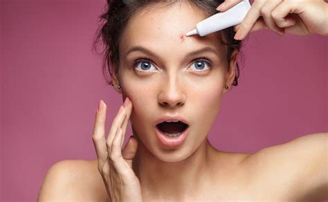 Acne Treatment: Medical or Cosmetic? - Bend Dermatology Clinic