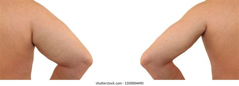 437 Arm fat before after Images, Stock Photos & Vectors | Shutterstock