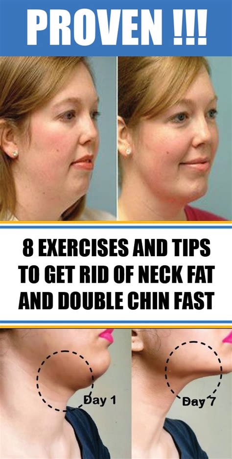 8 Exercises And Tips To Get Rid Of Neck Fat And Double Chin Fast # ...