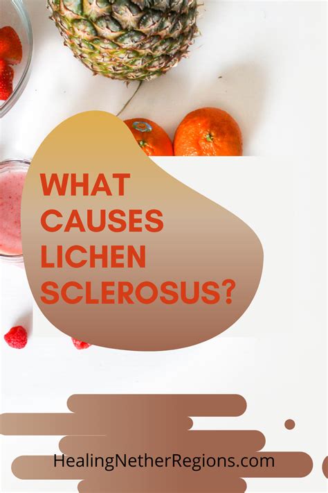 What's causing and triggering Lichen sclerosus? in 2021 | Lichen sclerosus, Lichen sclerosus ...