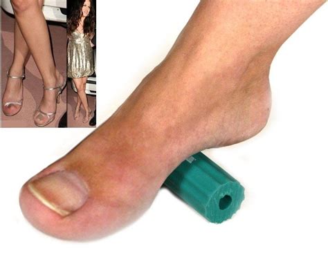 20 Photos That Will Make You Squirm If You Think Feet Are Weird | Foot ...