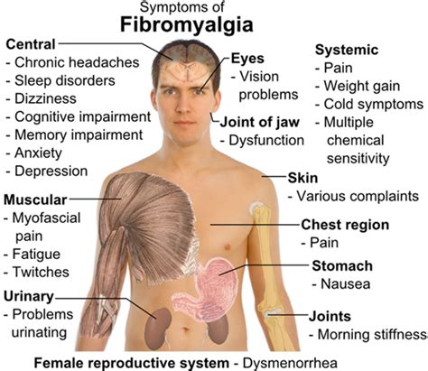 Welcome to Dr. Shenoy's CARE Hospital | Fibromyalgia