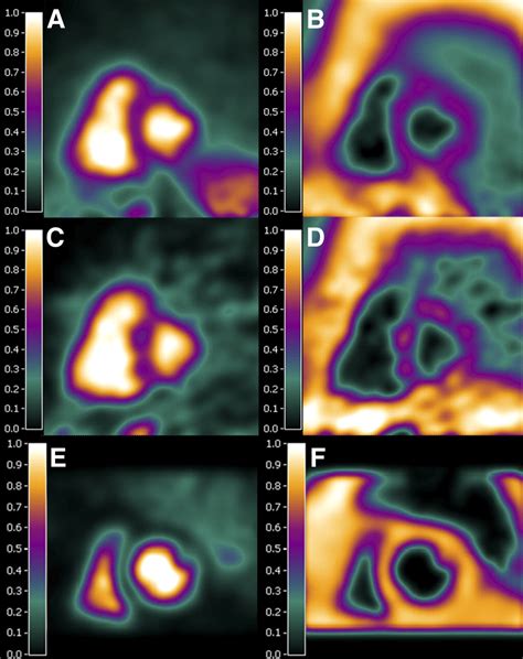 Nuclear Functional Study - SNMMI