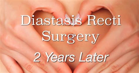 Diastasis Recti Surgery Update: 2 Years Later - It's A Love/love Thing