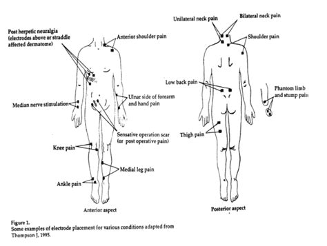 TENS - Transcutaneous electronic nerve stimulation pain control unit ...