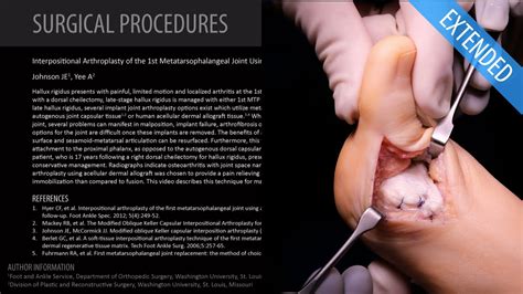 Arthroplasty of the 1st MTP Joint Using Acellular Allograft - Extended ...