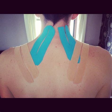 Kinesiology tape application for neck and shoulder pain… Pilates, Neck And Shoulder Pain, Neck ...