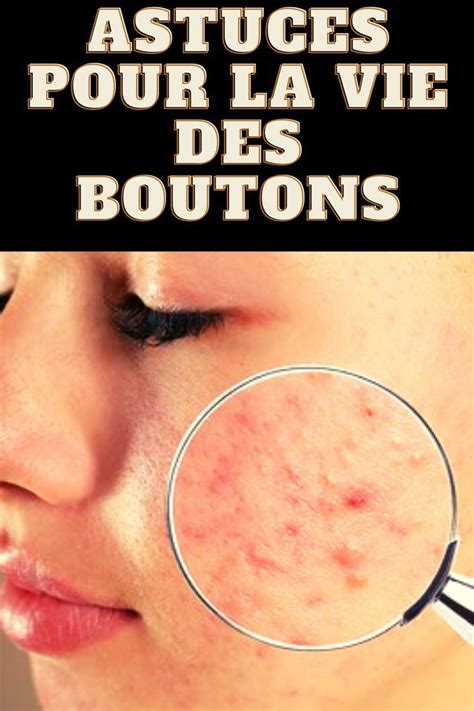 astuces pour la vie des boutons | Schönheit geheimtipp ...