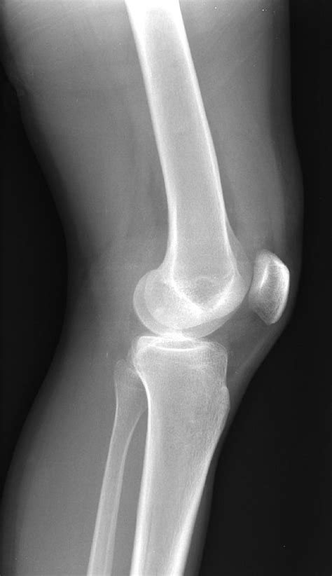 Pin on X-rays