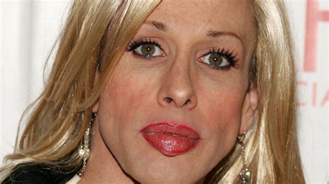 Alexis Arquette's Cause of Death Revealed: The Actress Battled HIV For 29 Years