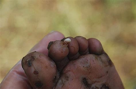 Pulgas de arena en Vietnam y Tailandia (foto) y lo que es importante saber sobre ellas