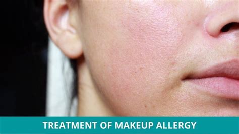 What is the Most Common Makeup Allergy? - Makeup Analysis